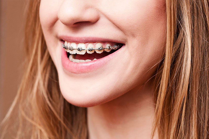Orthodontics in Kendall Park & Florham Park