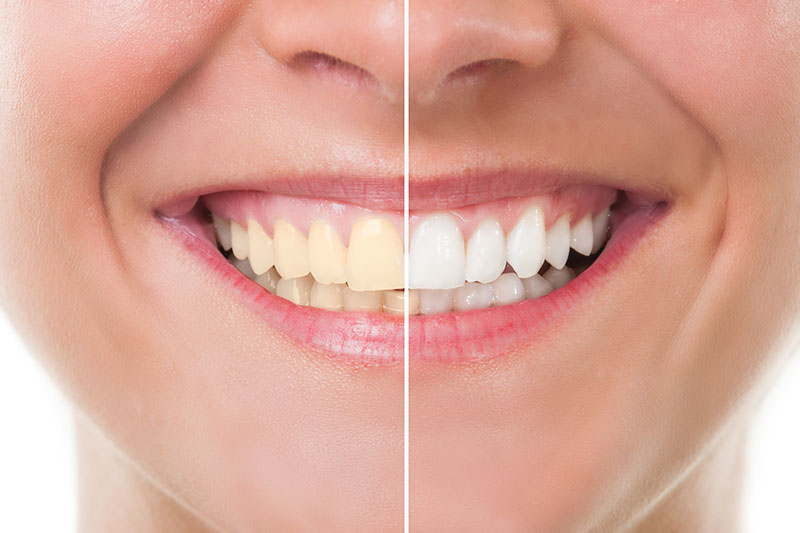 American Family Dentistry  Special Offer