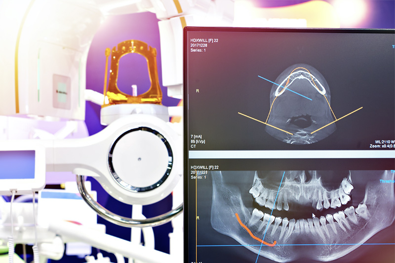 Digital X-Rays in Kendall Park & Florham Park