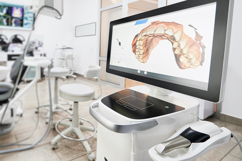 Intra-Oral Scanner in Kendall Park & Florham Park